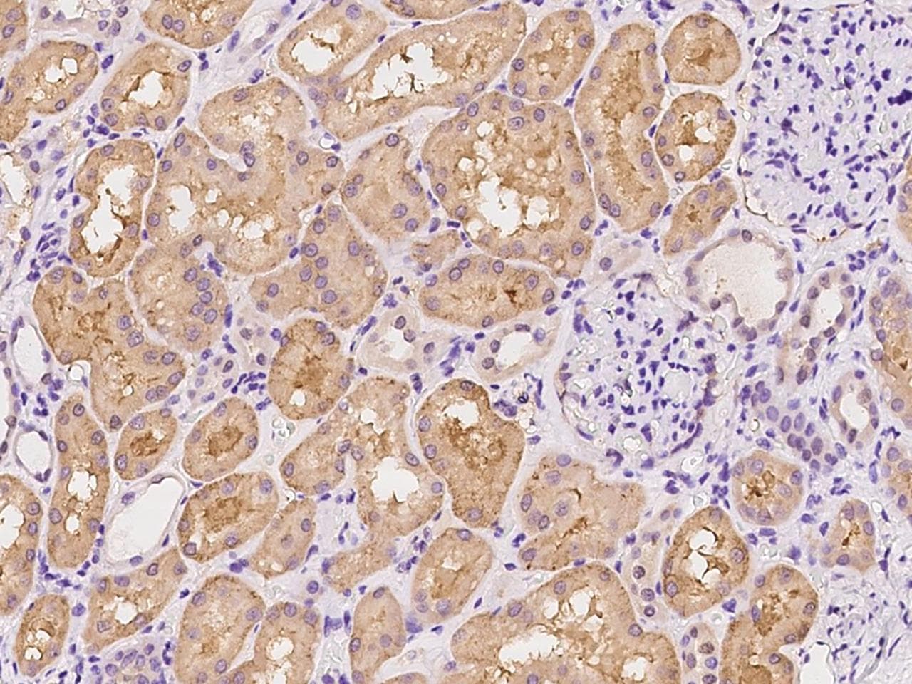 SDC1 / Syndecan 1 / CD138 Antibody (clone 160, Preservative Free)