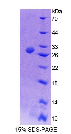 Mouse TCEA2 / TFIIS Protein (Recombinant His-T7, N-terminus)