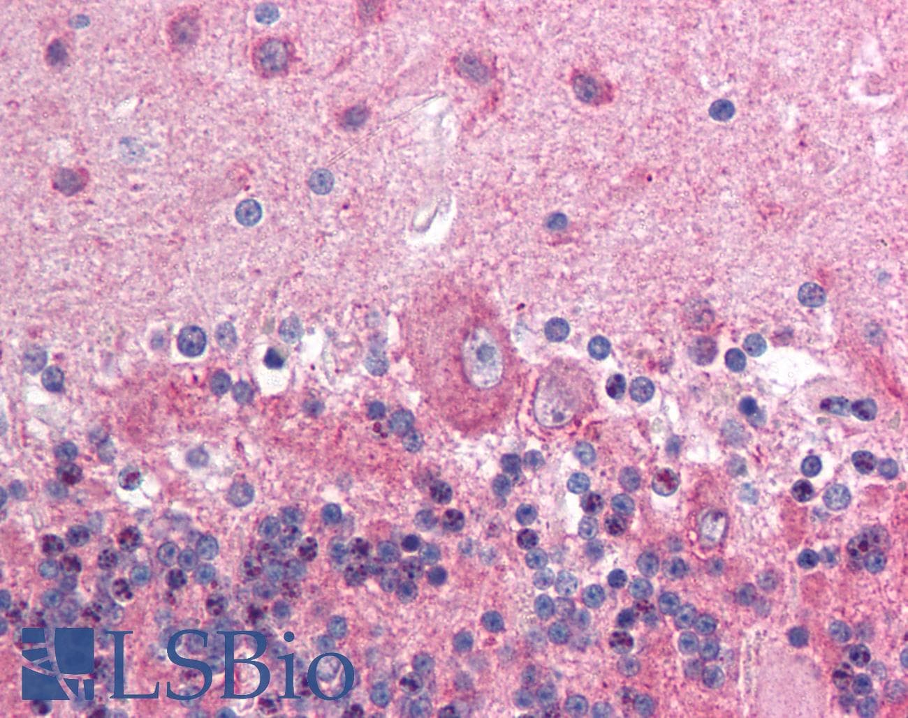 N-CoR / NCOR1 Antibody (aa484-533)