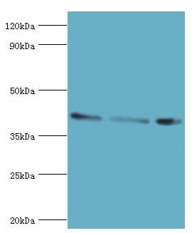 ARFGAP1 Antibody (aa1-220)