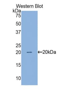 BIRC5 / Survivin Antibody (aa1-142)