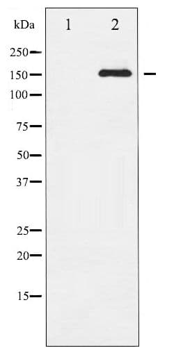Polyclonal Rabbit anti-Human EGFR Antibody (phospho-Ser1071, WB)