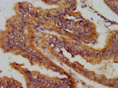 Polyclonal Rabbit anti-Human AS3MT Antibody (IHC, IF)