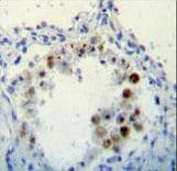 Polyclonal Rabbit anti-Human CDKN2B / p15 INK4b Antibody (aa102-130, IHC, IF, WB)