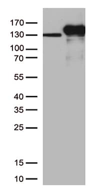 CDH2 / N Cadherin Antibody (clone UMAB23, Carrier-free)