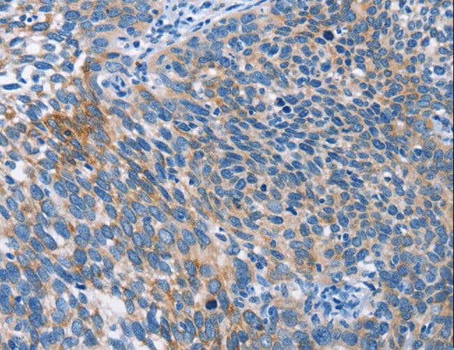 AHR Antibody