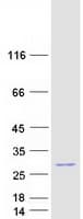 Human FAM177B Protein (Recombinant Myc-DDK (Flag))