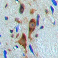 HDAC6 Antibody (N-Terminus)