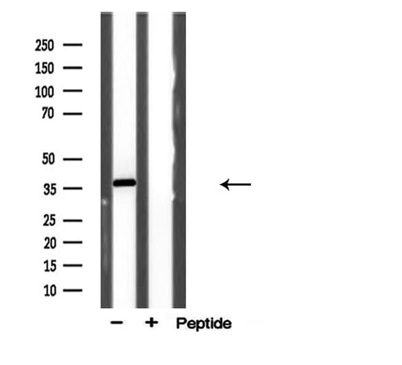 AKR1E2 Antibody