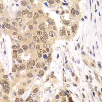 RNF2 / RING2 / RING1B Antibody