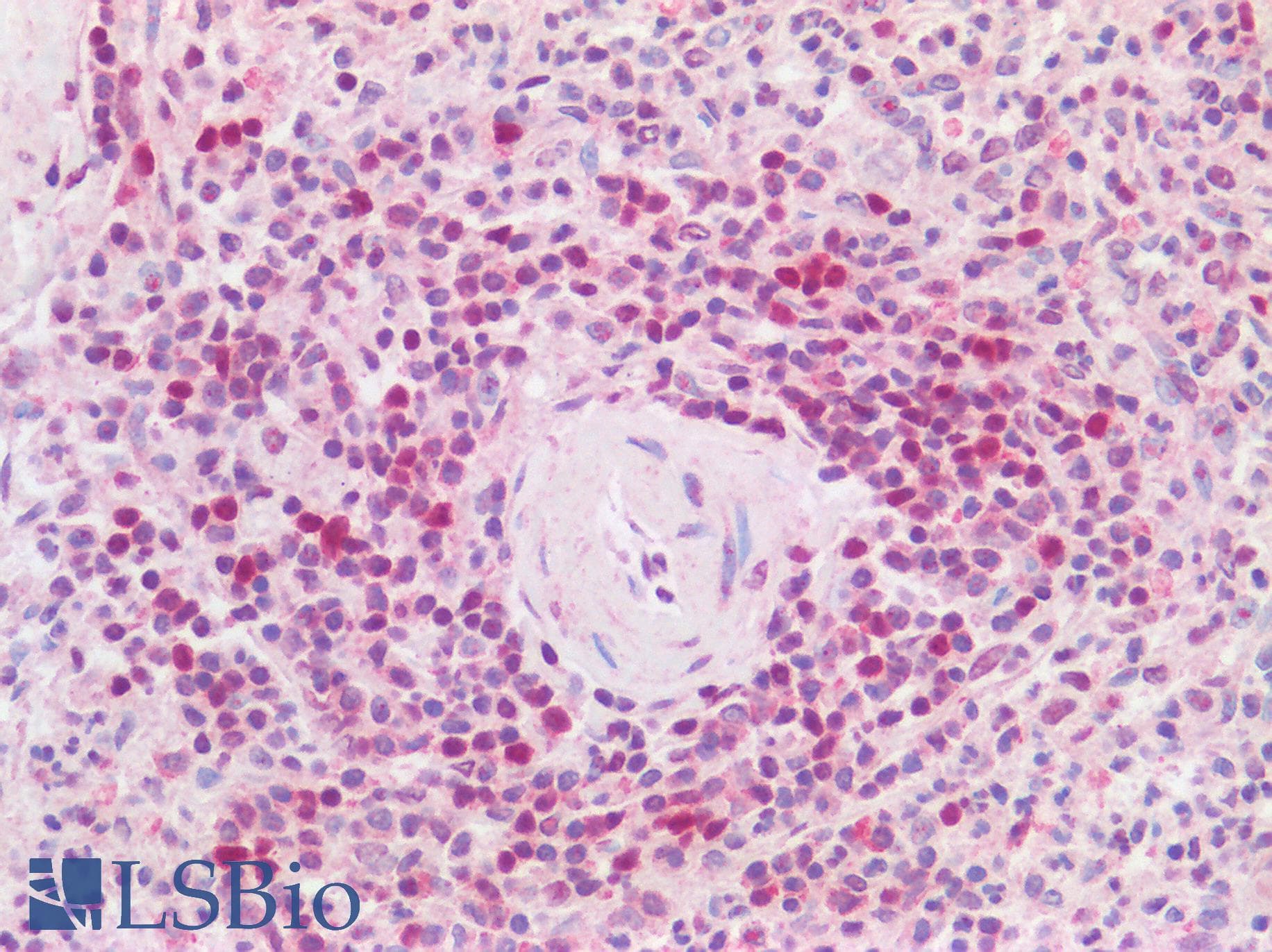 IHC-plus™ HDGFRP2 Antibody (aa425-475)