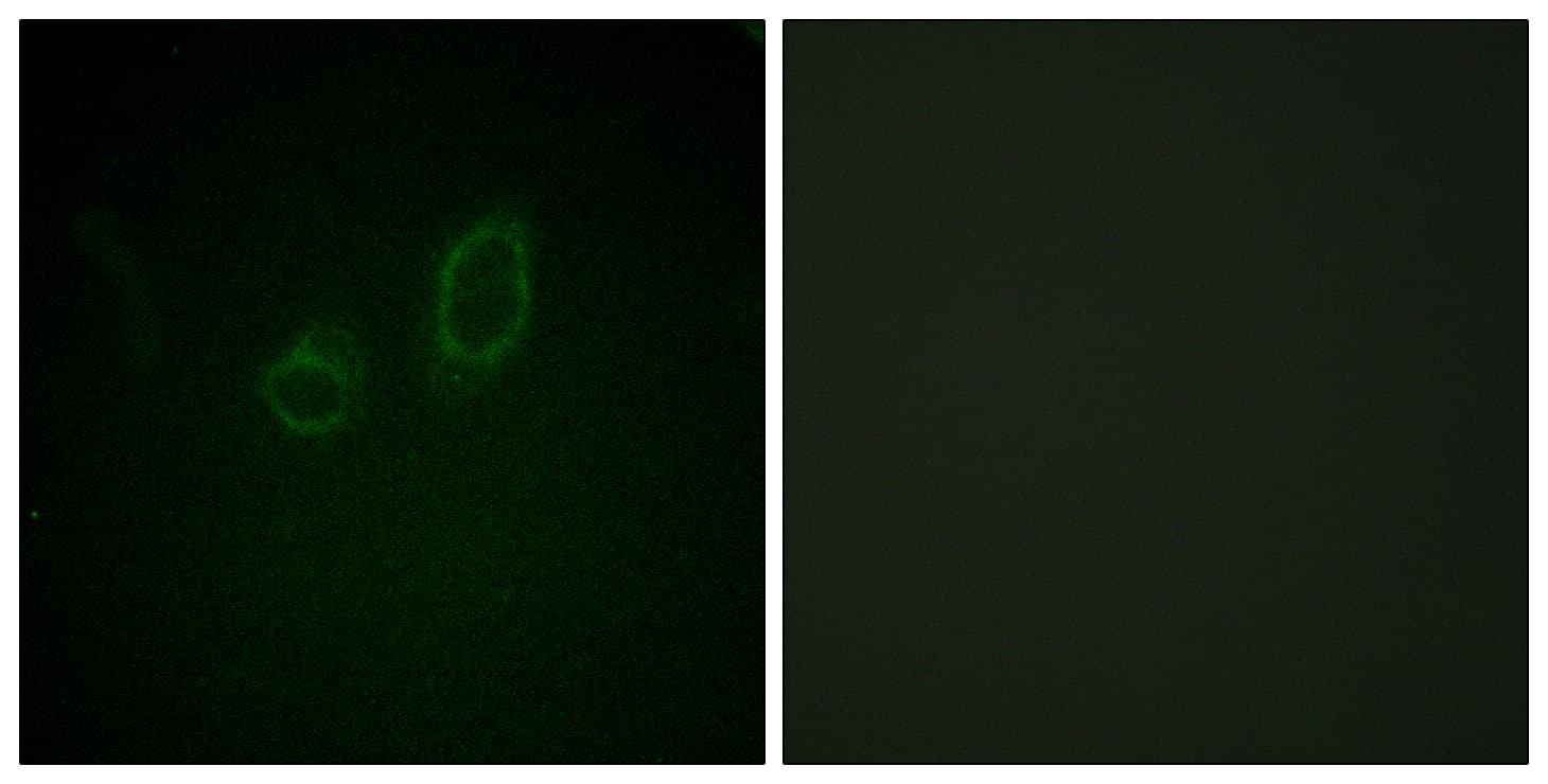 Ezrin + Radixin + Moesin Antibody (phospho-Thr558)