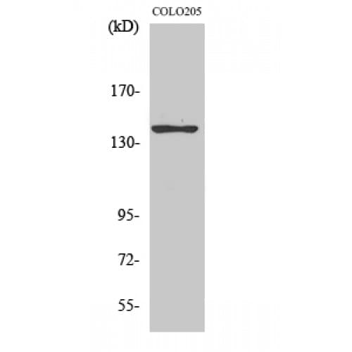 Polyclonal Rabbit anti-Human ADCY5+6 Antibody (900-980 aa, C-terminal, IHC, IF, WB)