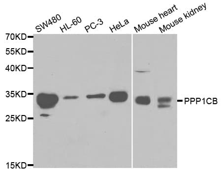 IHC-plus™ Polyclonal Rabbit anti-Human PPP1CB Antibody (IHC, IF, WB)