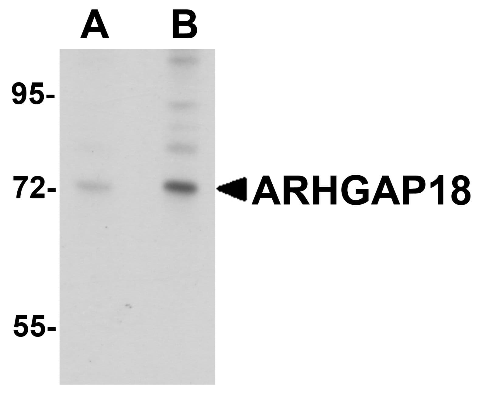 IHC-plus™ ARHGAP18 Antibody