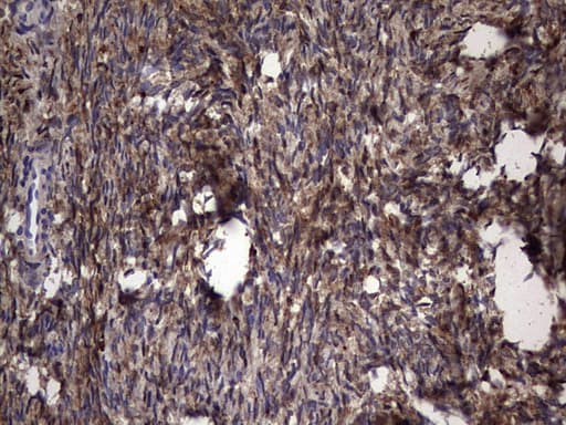 LGALS3 / Galectin 3 Antibody (clone OTI1C7)
