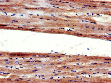 AGTR1 / AT1 Receptor Antibody