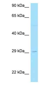 LAT2 / NTAL Antibody (aa171-220)
