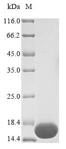 Bordetella bronchiseptica BB3856 Protein (Recombinant 6His, N-terminus)