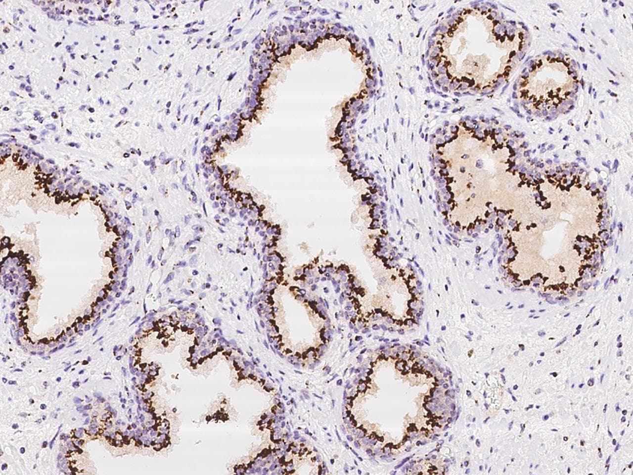 Polyclonal Rabbit anti-Human B4GALT1 Antibody (IHC, IF)