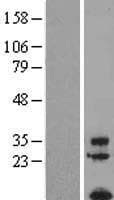 Human FAM19A1 Protein (Over-Expression Lysate Myc-DDK (Flag))