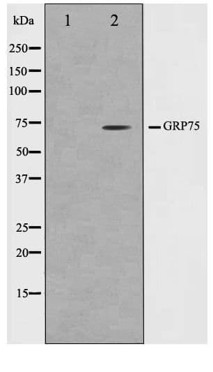 HSPA9 / Mortalin / GRP75 Antibody