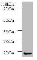 IHC-plus™ Polyclonal Rabbit anti-Human AP1S3 Antibody (IHC, WB)
