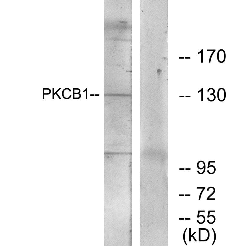 ZMYND8 / RACK7 Antibody