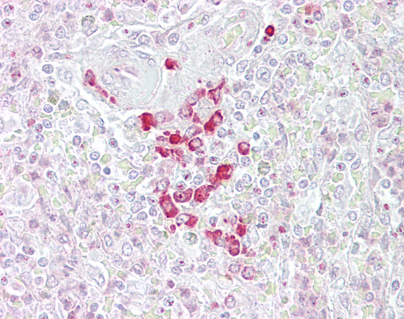 SFRP-3 / FRZB Antibody (aa216-265)