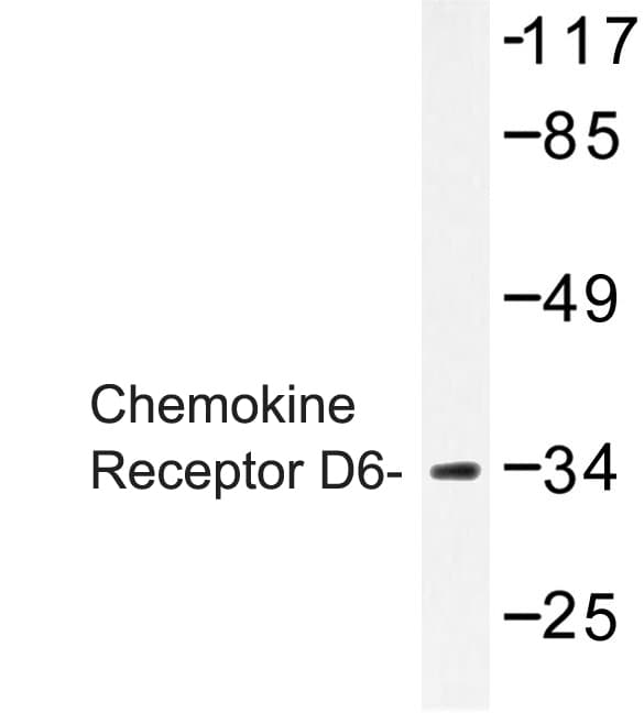 ACKR2 / CCR10 / D6 Antibody (Ser383)