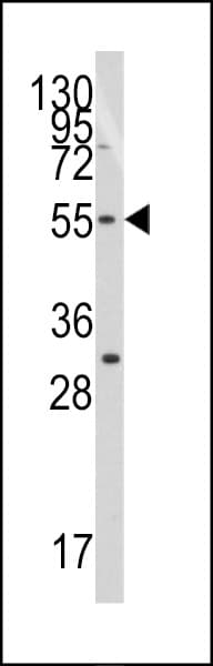 TRF1 / TERF1 Antibody (aa337-366)
