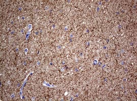 NF-L / NEFL Antibody (clone OTI3G2)