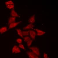 EPM2A / Laforin Antibody