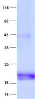 Human PTP4A3 Protein (Recombinant His, N-Terminal)