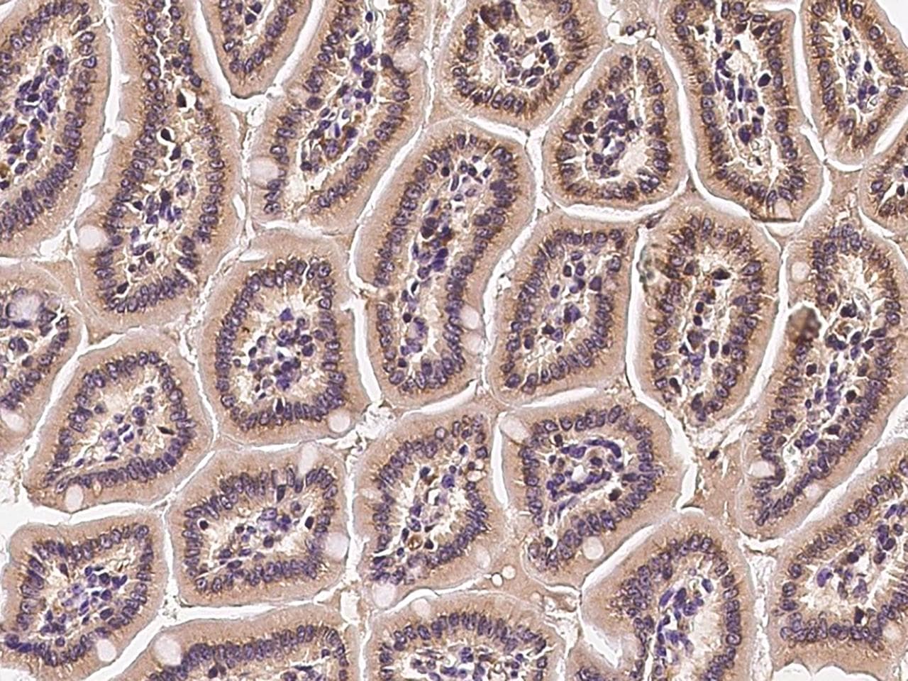 TRP32 / TXNL1 Antibody