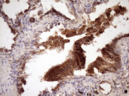 CTNNB1 / Beta Catenin Antibody (aa29-118, clone OTI2F10)