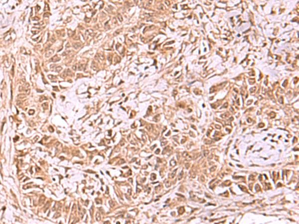TIP49 / RUVBL1 Antibody