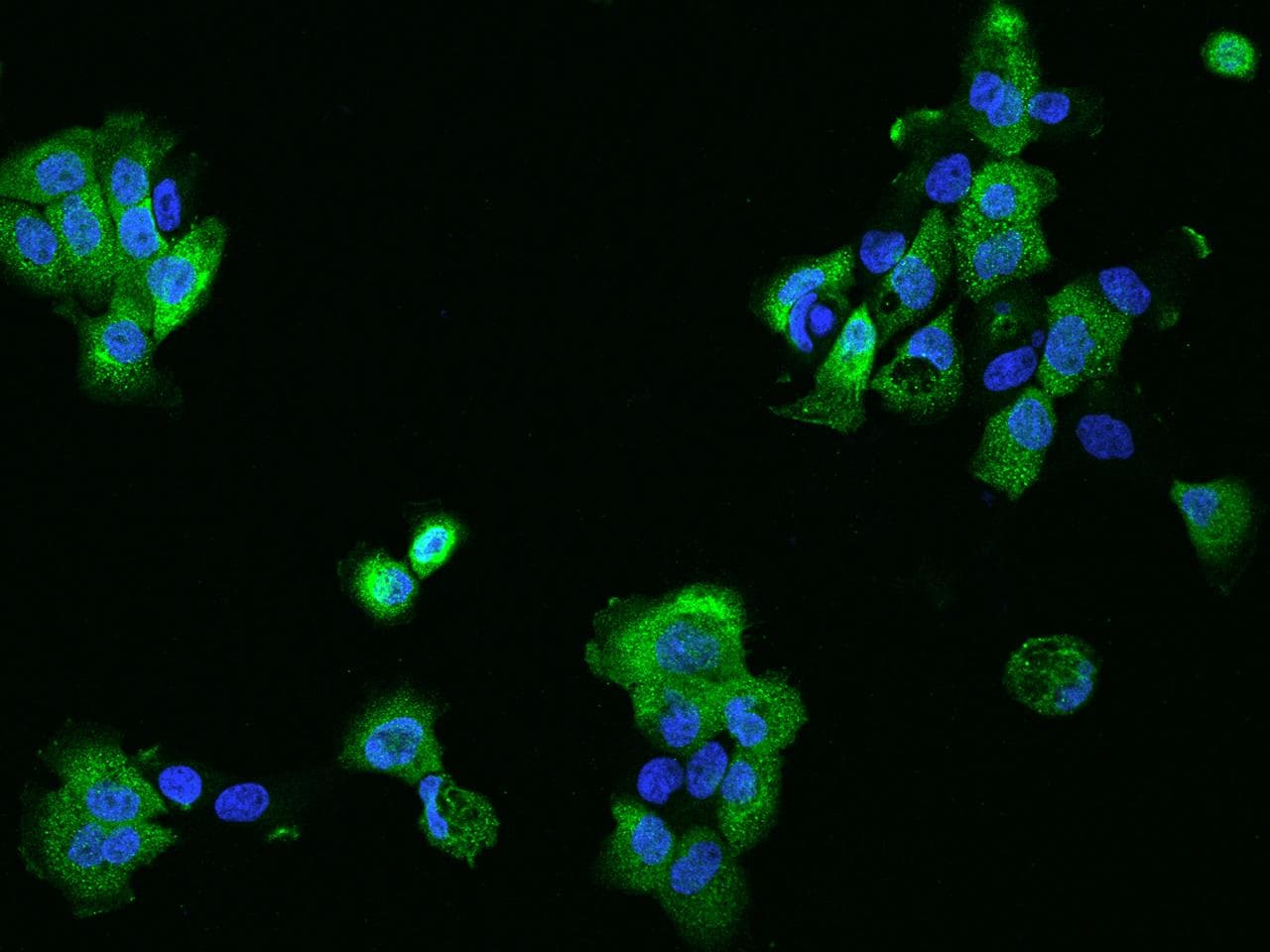 PHLDB2 Antibody