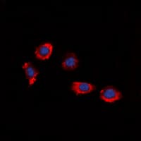 P2RY8 / P2Y8 Antibody (Internal)