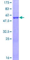 Human EXOSC4 / RRP41 Protein (Recombinant GST)