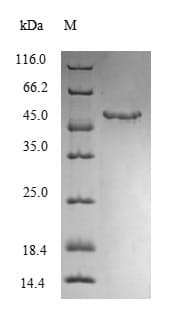 Human MGP / Matrix Gla-Protein (Recombinant 10His, N-terminus + Myc, C-terminus)