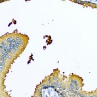 Polyclonal Rabbit anti-Human NYX Antibody (IHC, WB)