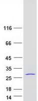 Human EIF3K Protein (Recombinant Myc-DDK (Flag))