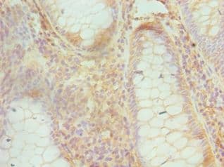 Polyclonal Rabbit anti-Human CUL1 / Cullin 1 Antibody (aa500-776, IHC)