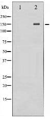 GRIN2B / NMDAR2B / NR2B Antibody