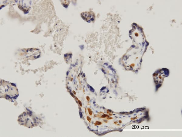 MKNK1 / MNK1 Antibody (clone 3E1)