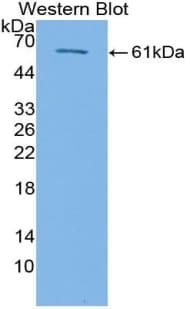 Betaglycan / TGFBR3 Antibody (aa469-724)