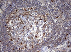 Monoclonal Mouse anti-Human TOP2A / Topoisomerase II Alpha Antibody (clone OTI2F8, aa1100-1531, IHC, WB)