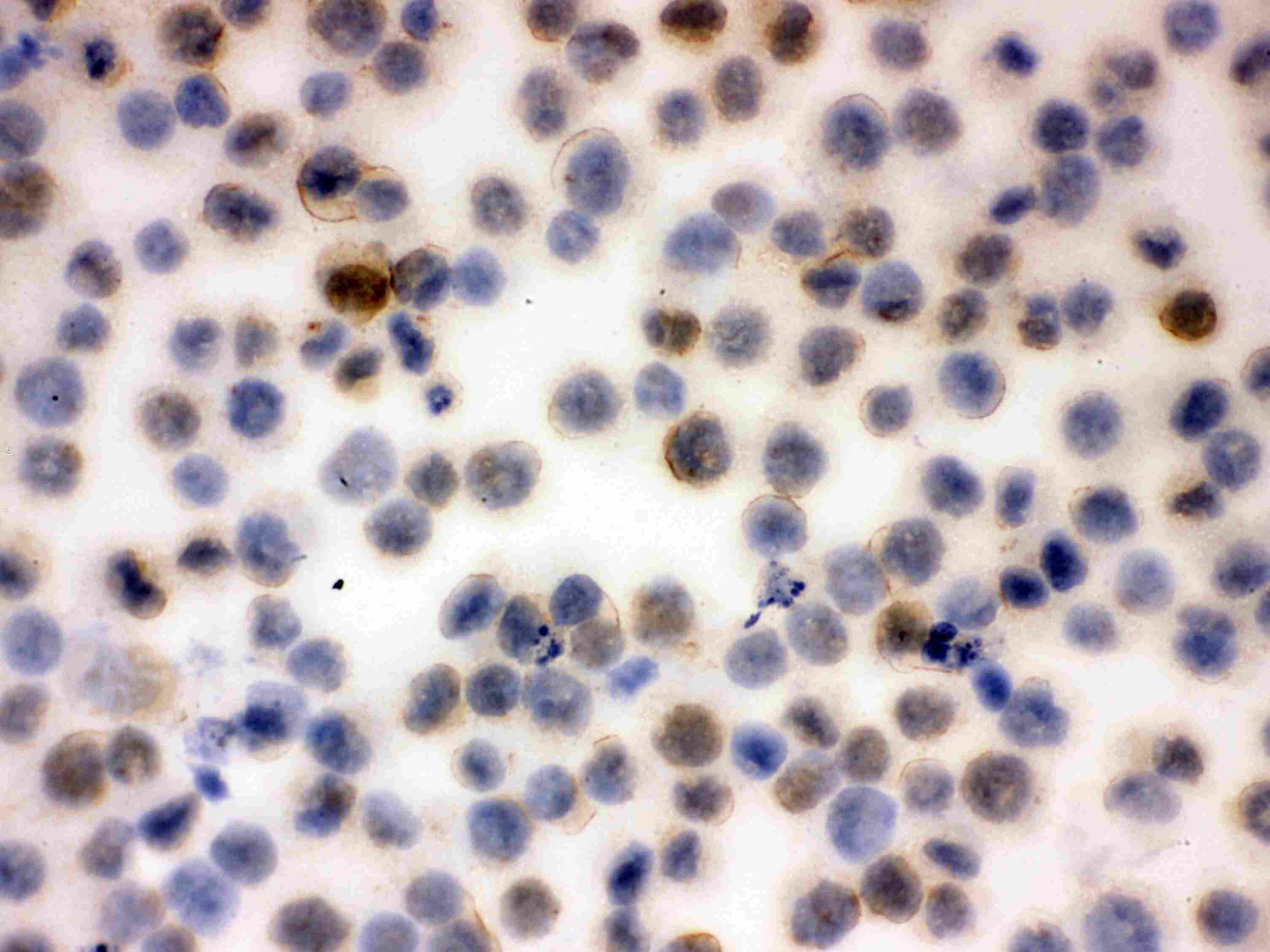 Polyclonal Rabbit anti-Human SPN / CD43 Antibody (aa272-400, IHC, WB)