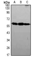 Polyclonal Rabbit anti-Human SLC2A2 / GLUT2 Antibody (IHC, WB)